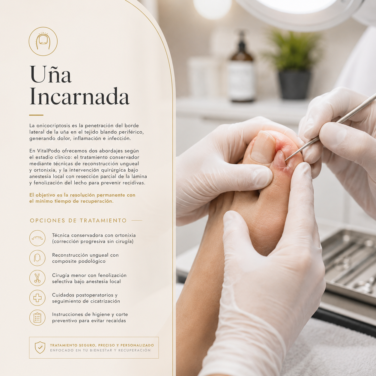 Uña Incarnada